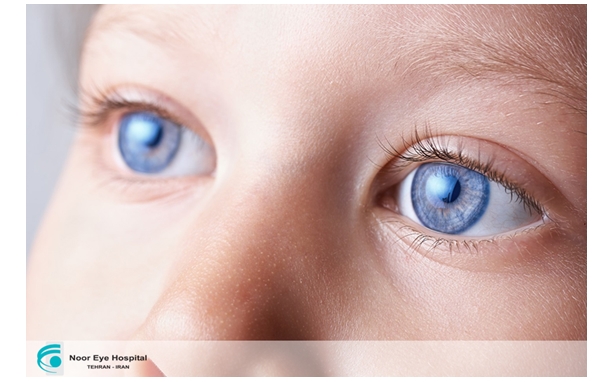 What We Should Know About Infantile Cataract